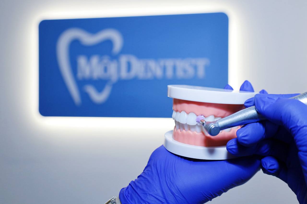 5226916912690827791 Profesionálna dentálna hygiena – základ zdravého a krásneho úsmevu