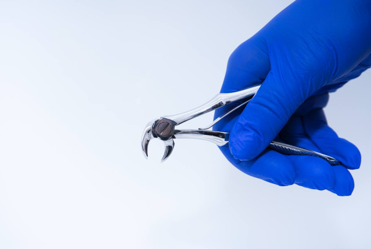 5226916912690827811 Odstránenie mliečneho zuba – jemne, pokojne a bez strachu