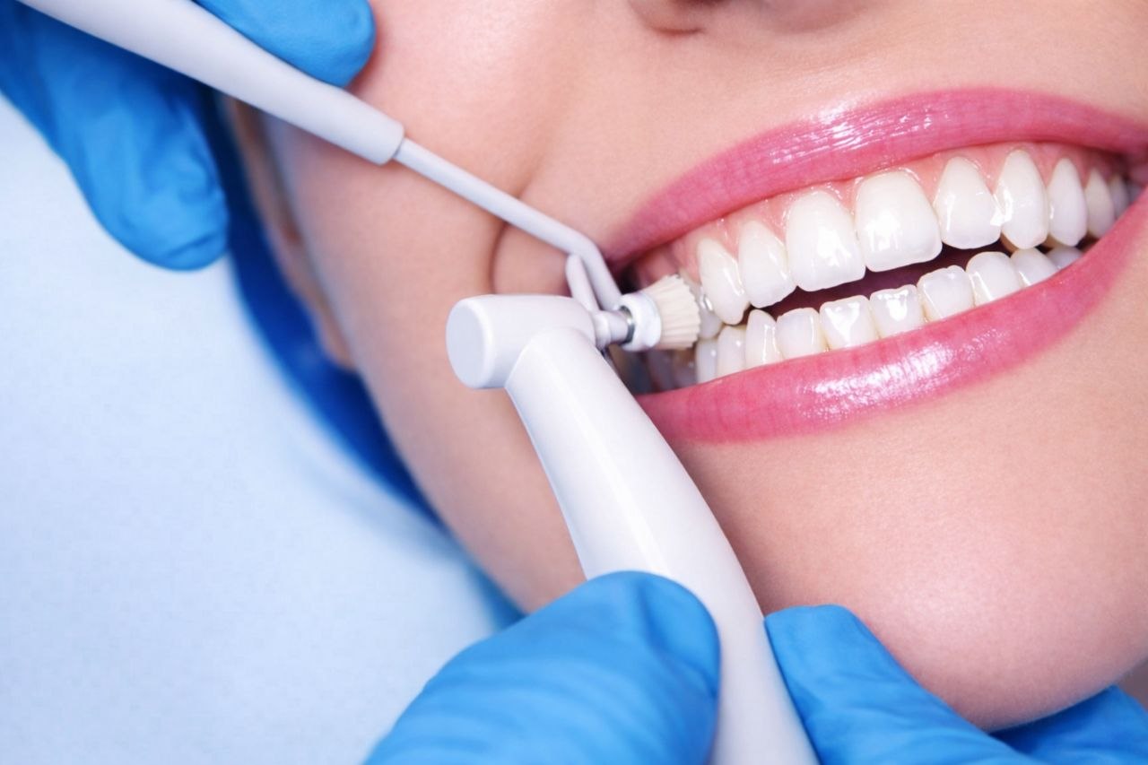 5917903259999866019 Profesionálna dentálna hygiena